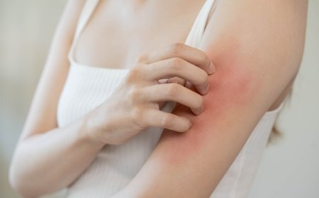 Kako vaša koža odražava opšte zdravlje vašeg organizma?