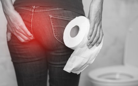 Čajevi za Hemoroide i drugi prirodni lijekovi